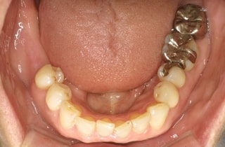 case2_3.jpg